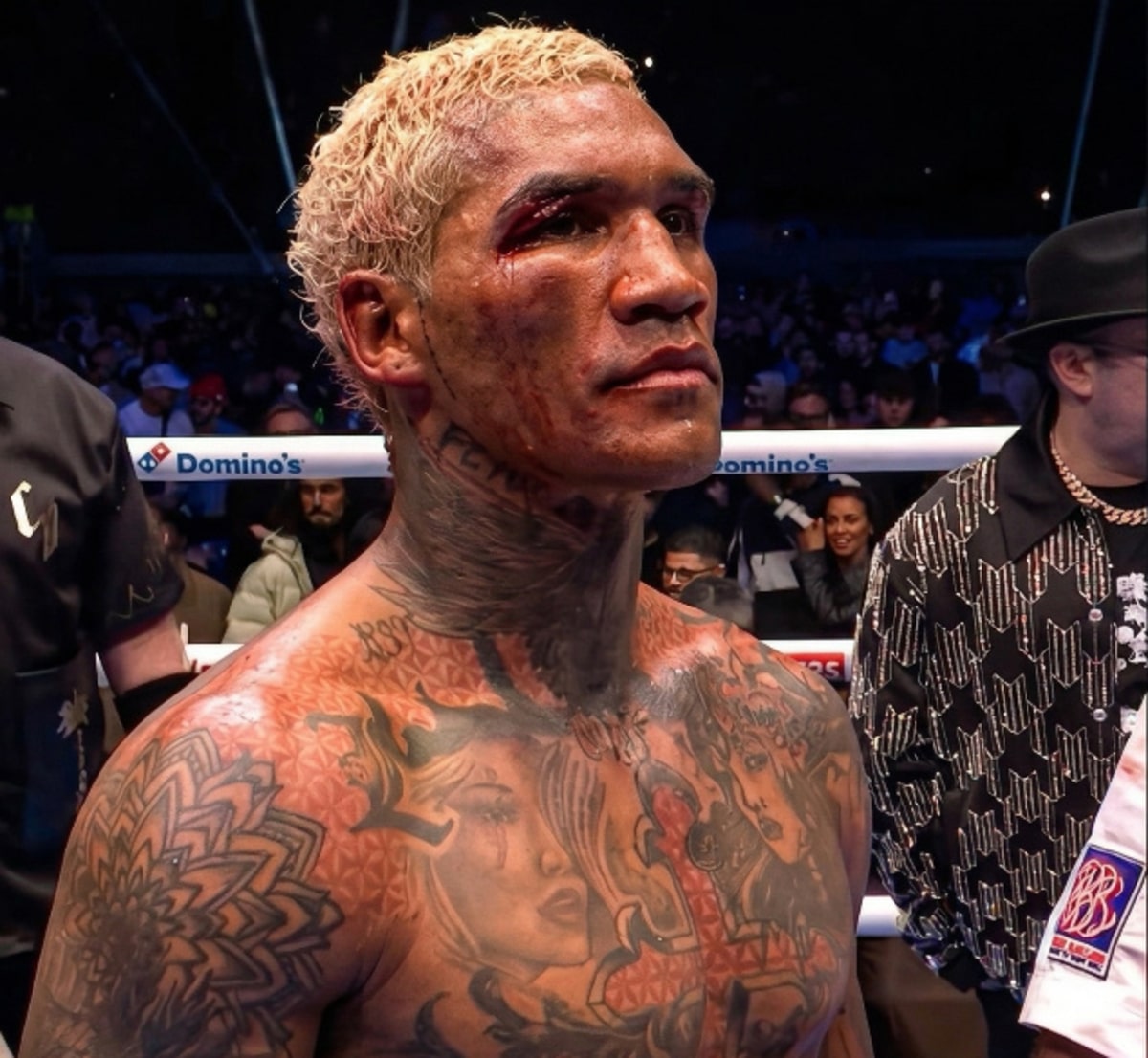 Conor Benn Win Gets No Interview, Quick Broadcast Cut
